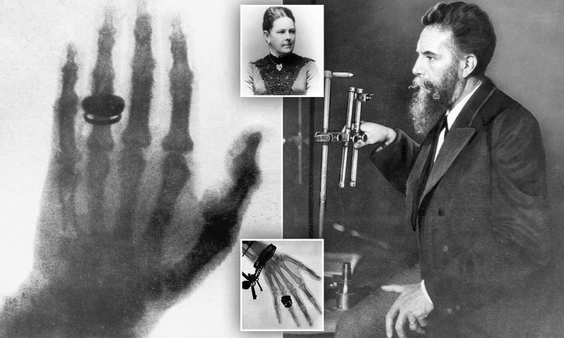 Origin of medical imaging