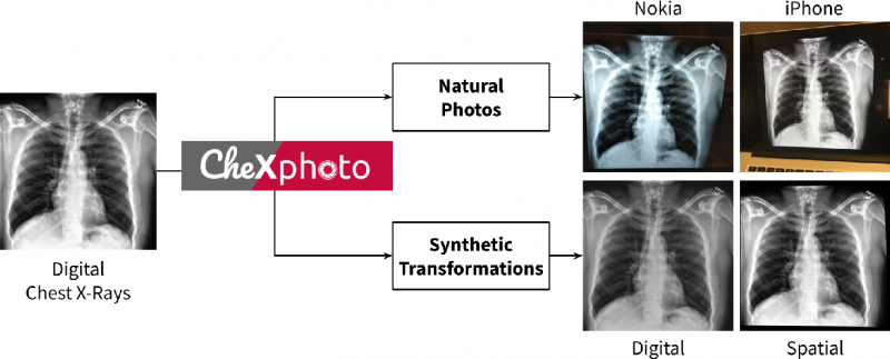 VINBRAIN AND STANFORD UNIVERSITY JOINED TO LAUNCH CHEXPHOTO COMPETITION FOR CHEST X-RAYS INTERPRETATION BY AI