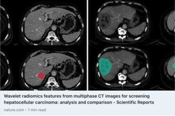 VINBRAIN TO PUBLISH THE PAPER “WAVELET RADIOMICS FEATURES FROM MULTIPHASE CT IMAGES FOR SCREENING HEPATOCELLULAR CARCINOMA: ANALYSIS AND COMPARISON” IN NATURE, THE TOP-TIER SCIENCE JOURNAL